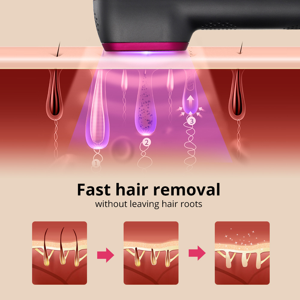 Handle Type 5-speed Whole Body Laser Hair Removal Instrument IPL Pulse Light Mild - Image 8